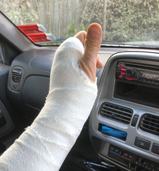 Aaron Hogg with broken hand - oof!